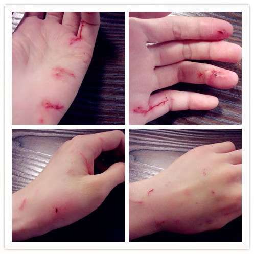 小孩逗猫,被抓伤了,我们需要负全责吗?