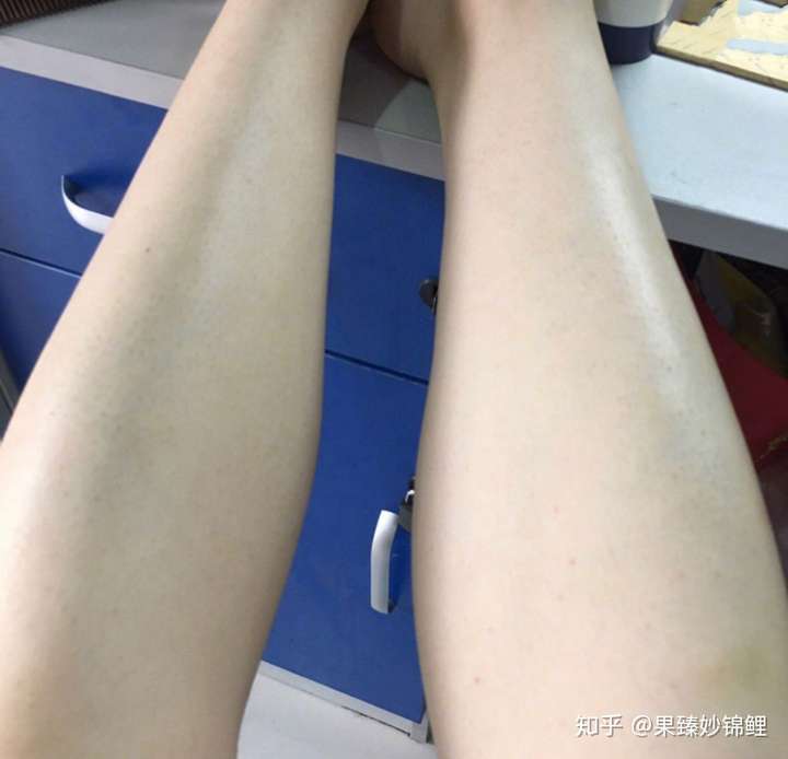涂身体乳要刮腿毛毛(刮完腿毛需要抹身体乳)