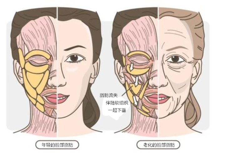 做面部提升热玛吉和有什么区别？