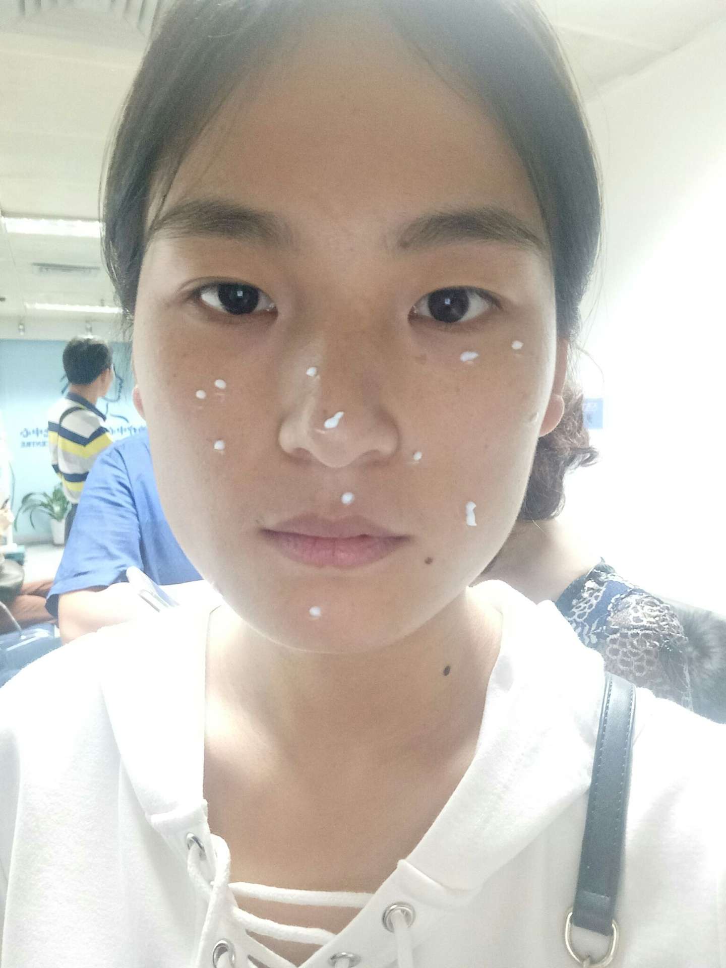 醫美 雷射除痣 把壞運除掉 好運進來 台南 許乃仁皮膚診所 娜塔 Nata S Colorful Life