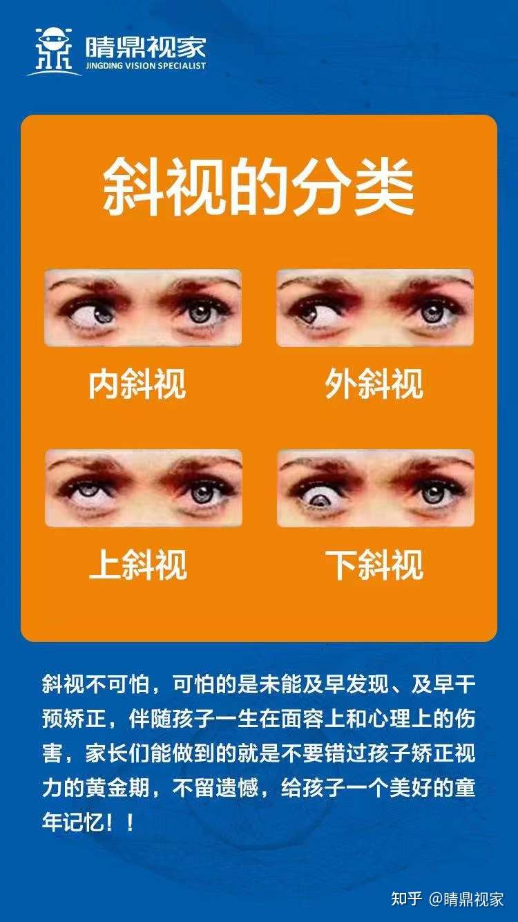 睛鼎视家 的想法: #睛鼎视家·斜视科普篇 ⁉️孩子一直玩手… - 