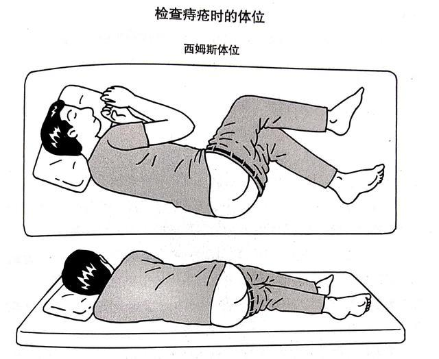 去大医院检查痔疮大概检查费用得多少?