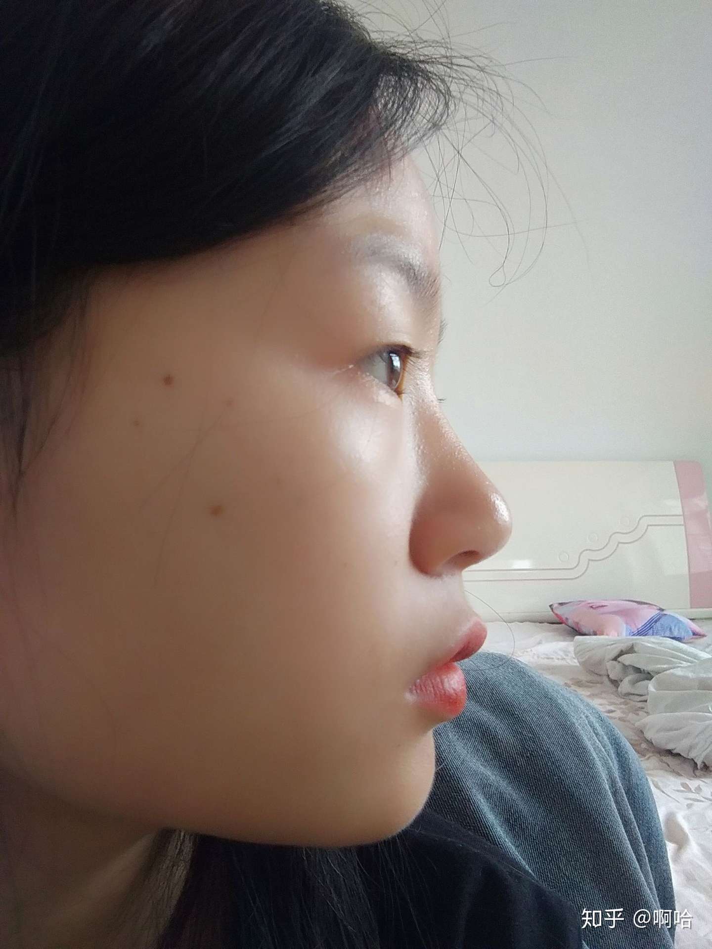 上嘴突出嘴巴厚 知乎