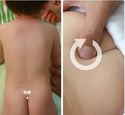 小儿推拿真人图解版教程，家有宝宝学起来丨小儿推拿真人图片宣传海报