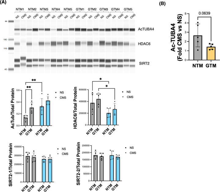 微管蛋白乙酰化增強機械應力下小梁網細胞的微管穩定性