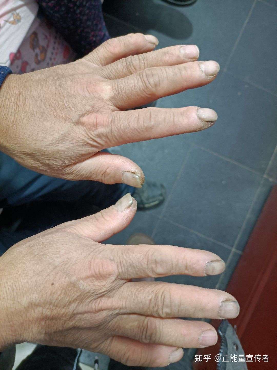 父亲的手 知乎