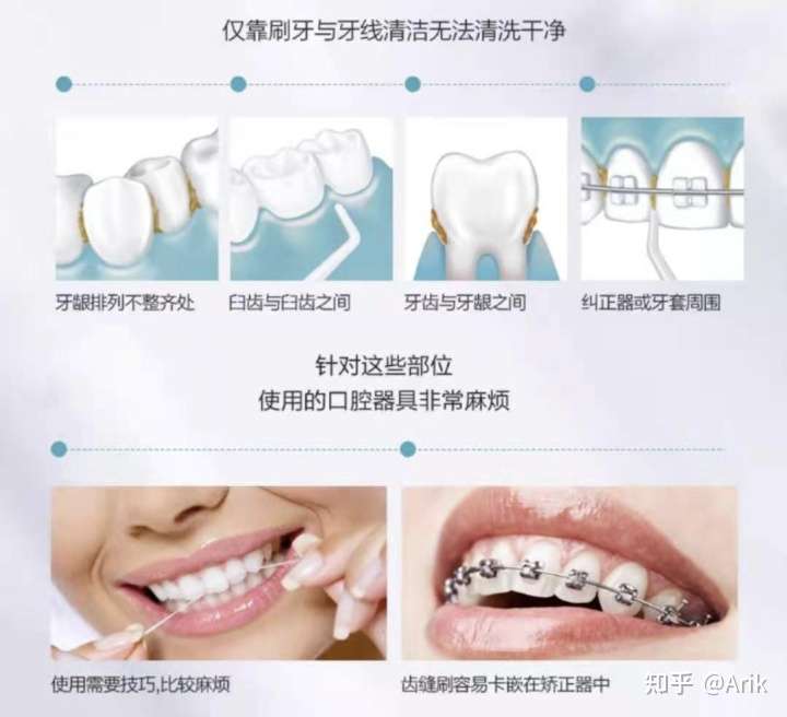 冲牙器有必要买吗 冲牙器有用吗 21年冲牙器推荐 最火的9款冲牙器真机测评 知乎