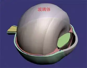 折叠式人工玻璃体球囊图片