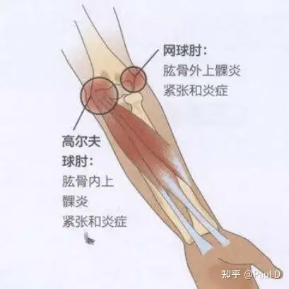 肘腕问题评估及纠正性训练1