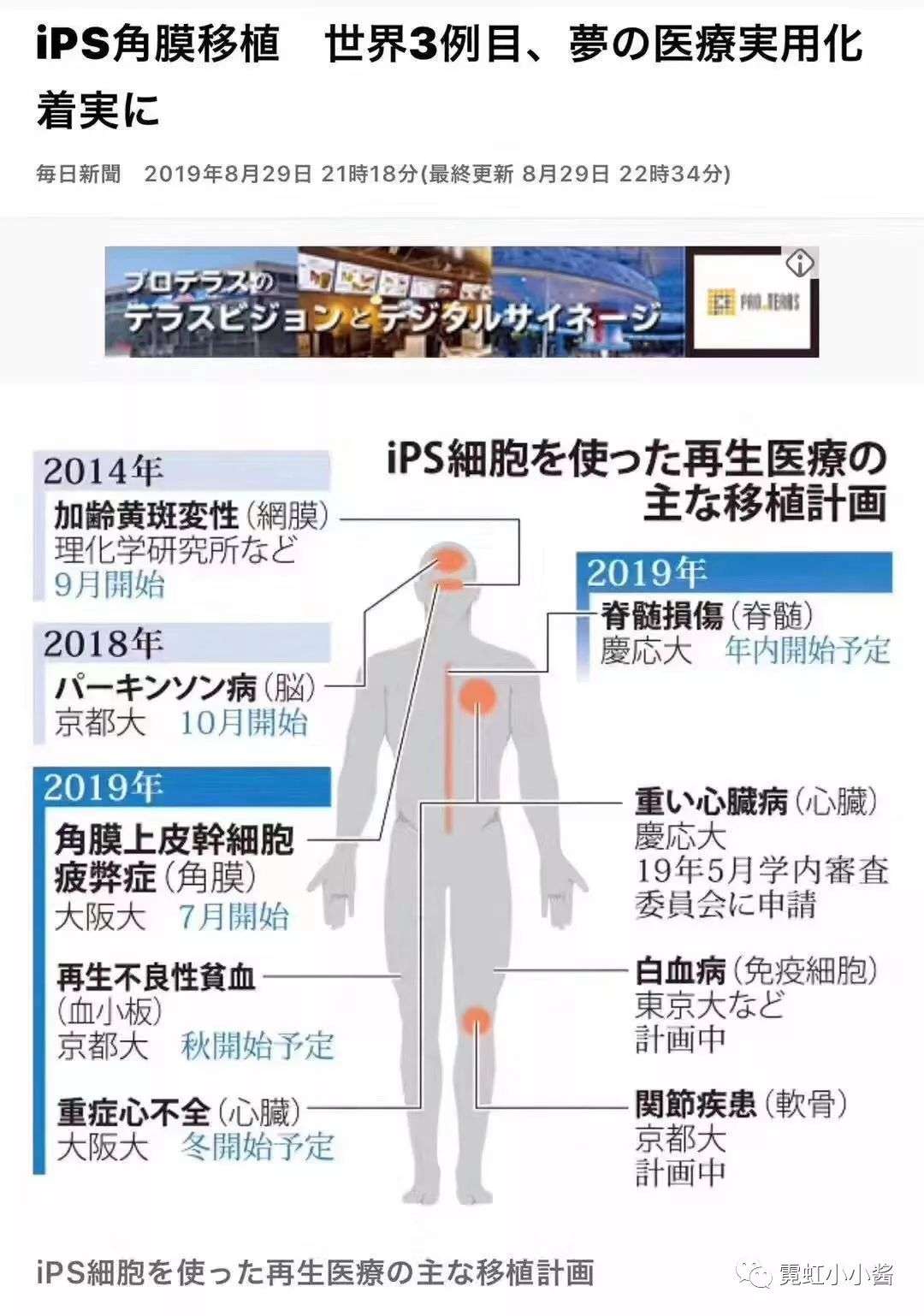 人类壮举 全球首例ips制成眼角膜移植成功 日本医疗 知乎