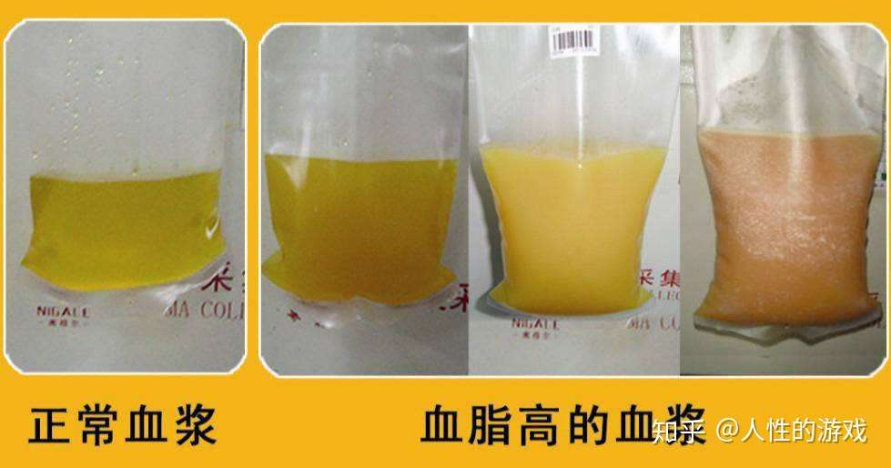 新型冠状病毒116 血量 血容量 血管容量 心搏出量 知乎