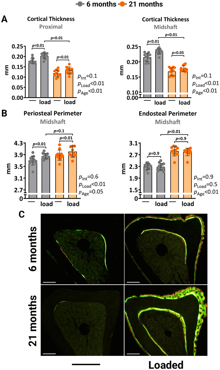 成骨細(xì)胞系細(xì)胞中的線粒體氧化應(yīng)激或自噬減少不足以模擬衰老對(duì)骨機(jī)械反應(yīng)性的有害影響 成骨細(xì)胞系細(xì)胞中的線粒體氧化應(yīng)激或自噬減少不足以模擬衰老對(duì)骨機(jī)械反應(yīng)性的有害影響