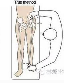 长短腿 磨人不浅 立即学习矫正吧 知乎