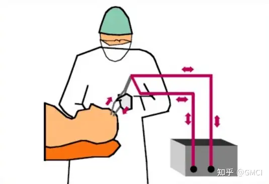 德國(guó)GMC醫(yī)療質(zhì)控提供高頻電刀測(cè)試方法插圖2
