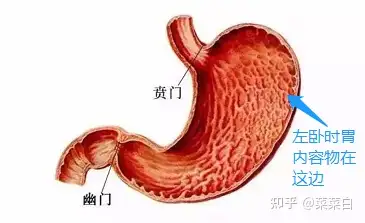 因為賁門在胃的右上方(右手對應胃的右邊)向左彎折連接胃部,所以如果