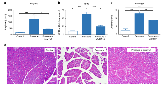 Piezo1是一種介導壓力誘導胰腺炎的機械激活離子通道