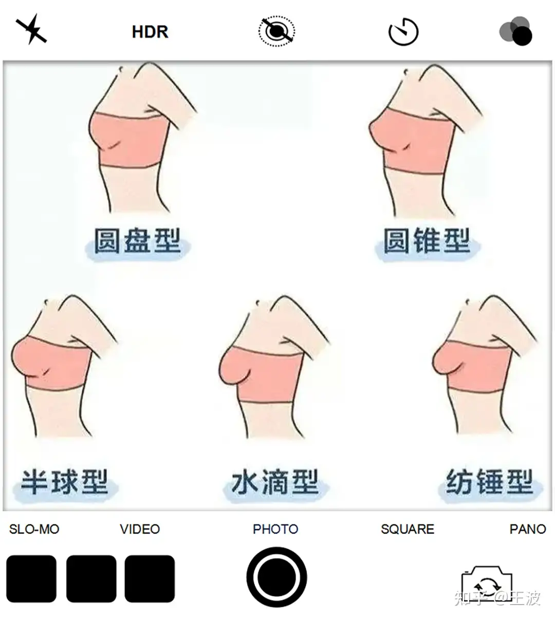 半球 型 胸