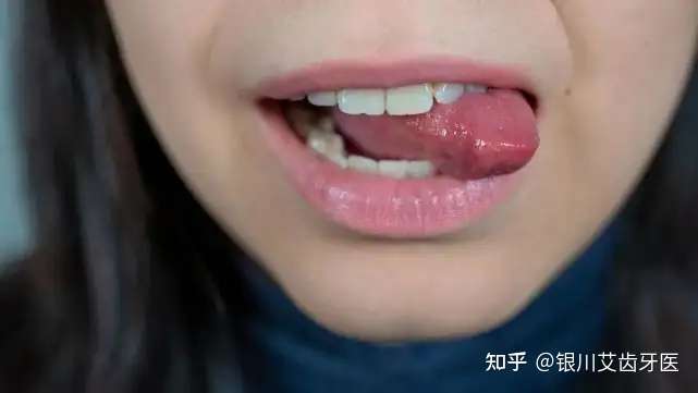 也可能是舌头问题
