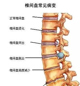 82b8bb50418704bdadeb9c26e6a423d4_b.jpg