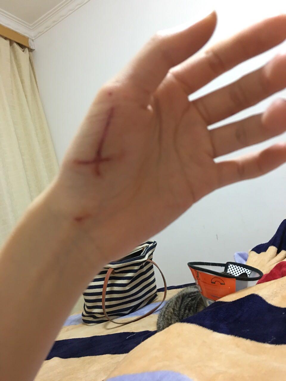 切菜被刀割了一个小口子,去医院包扎下要 190,这收费合理吗?