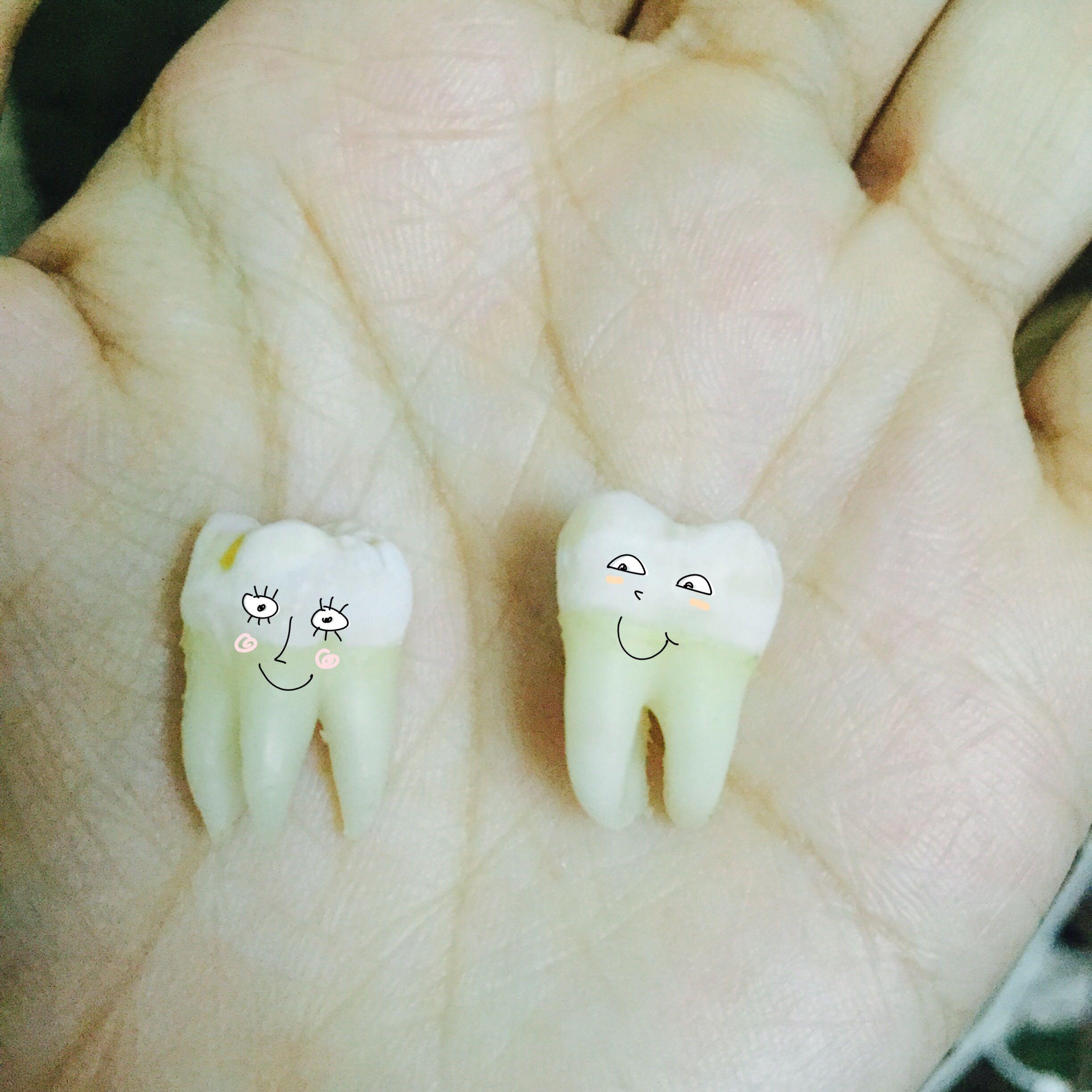 拔智齿有多痛? - 锅达的回答 - 知乎