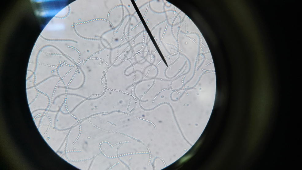 白色念珠菌厚膜孢子图片