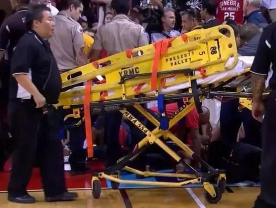 8个月从小腿骨折康复——保罗乔治