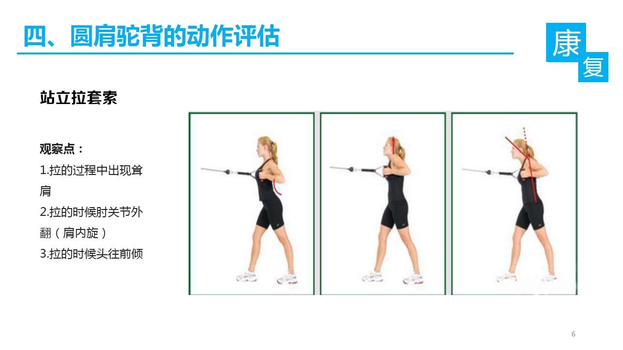 如何纠正含胸、驼背、头前伸？ - 知乎
