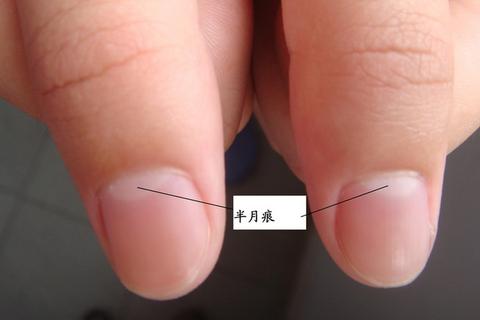 半月痕 知乎 半月痕 知乎