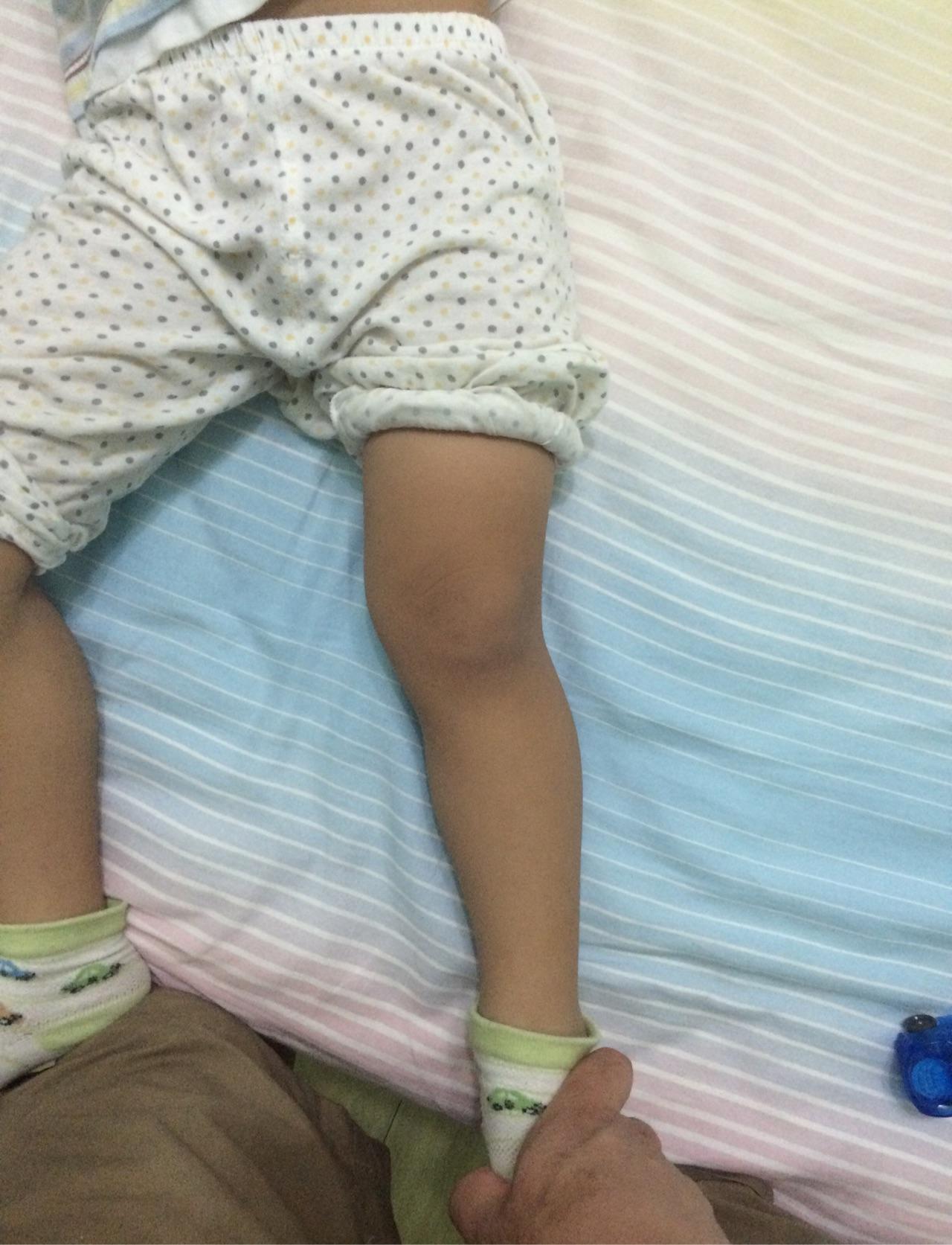 可爱宝宝的腿图片素材-编号27444195-图行天下