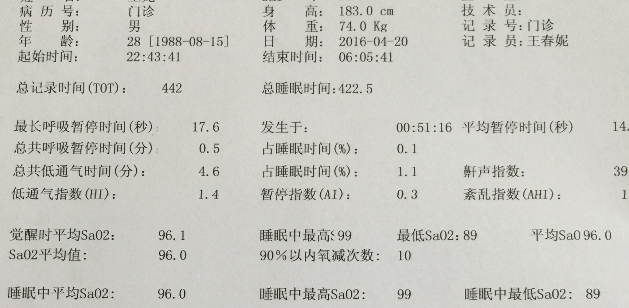 多导睡眠监测数据解读? - 知乎