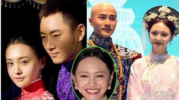 如何评价郑爽整容之后的五官