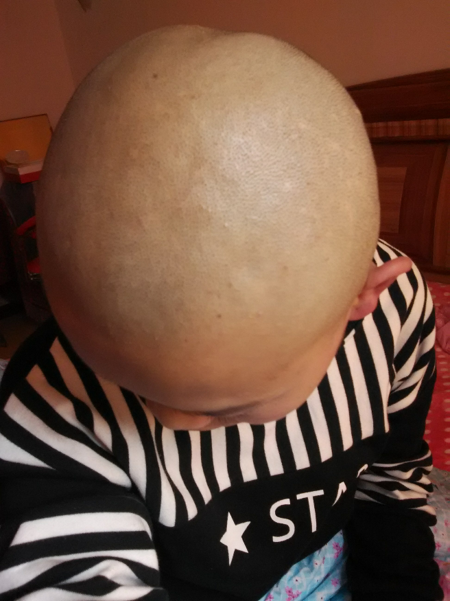 女生剃光头多久头发能留到bobo头长度