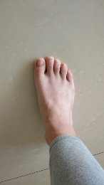 脚宽怎么瘦脚? - 足 - 知乎