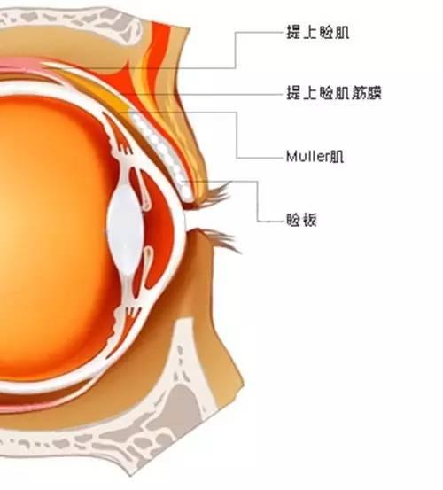 muller肌眼睑图片