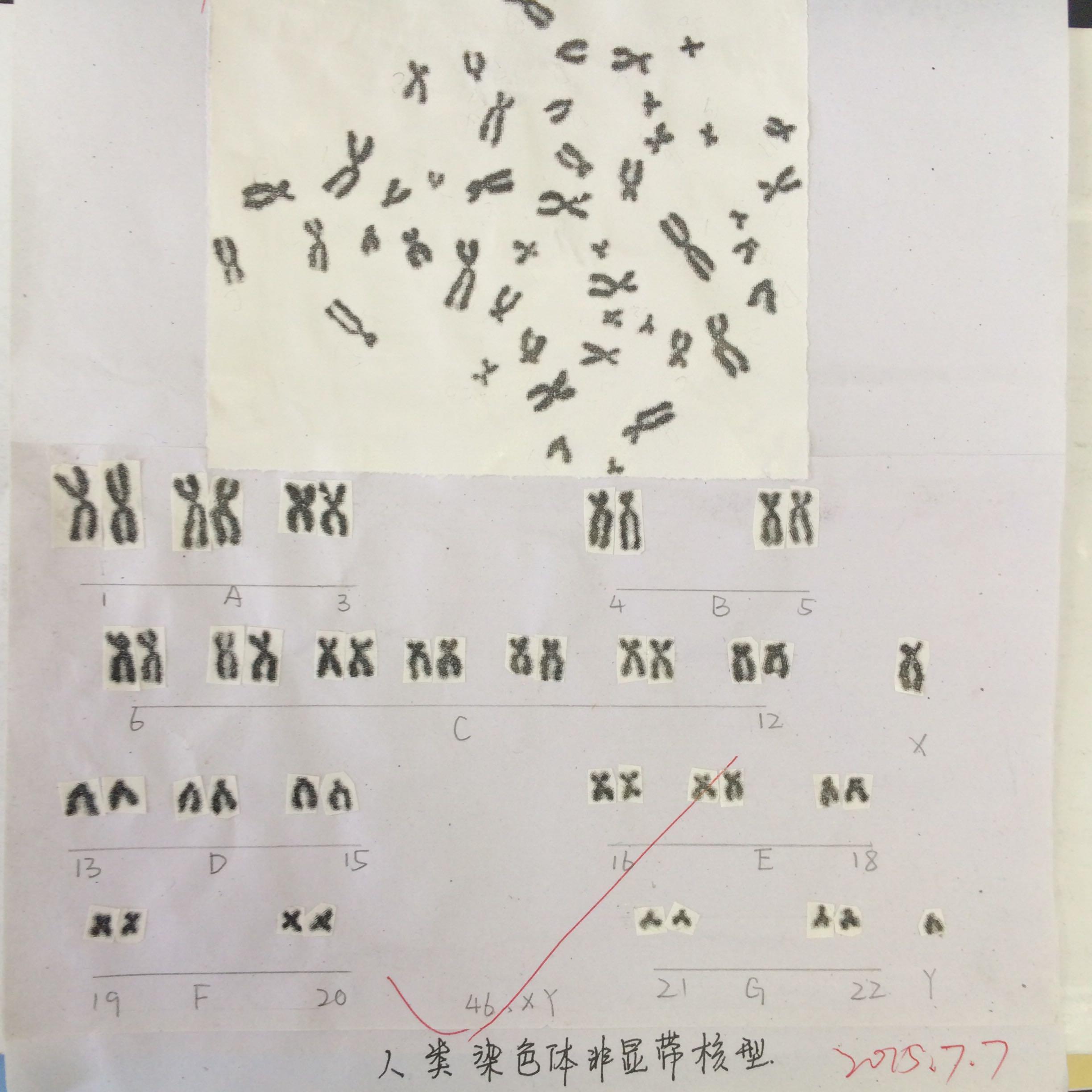 人类染色体图谱口诀图片