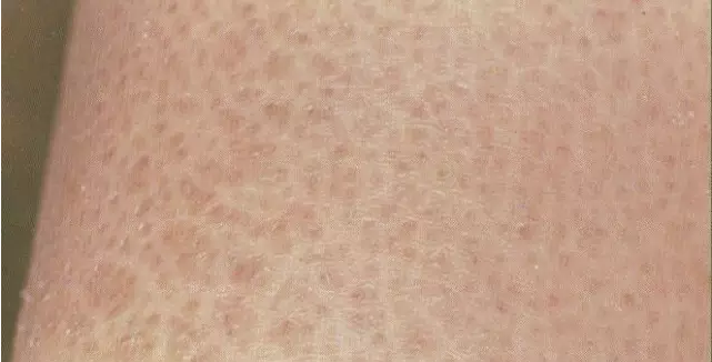 b1096347ef99518bde4ba27e7d12e48b_r.jpg
