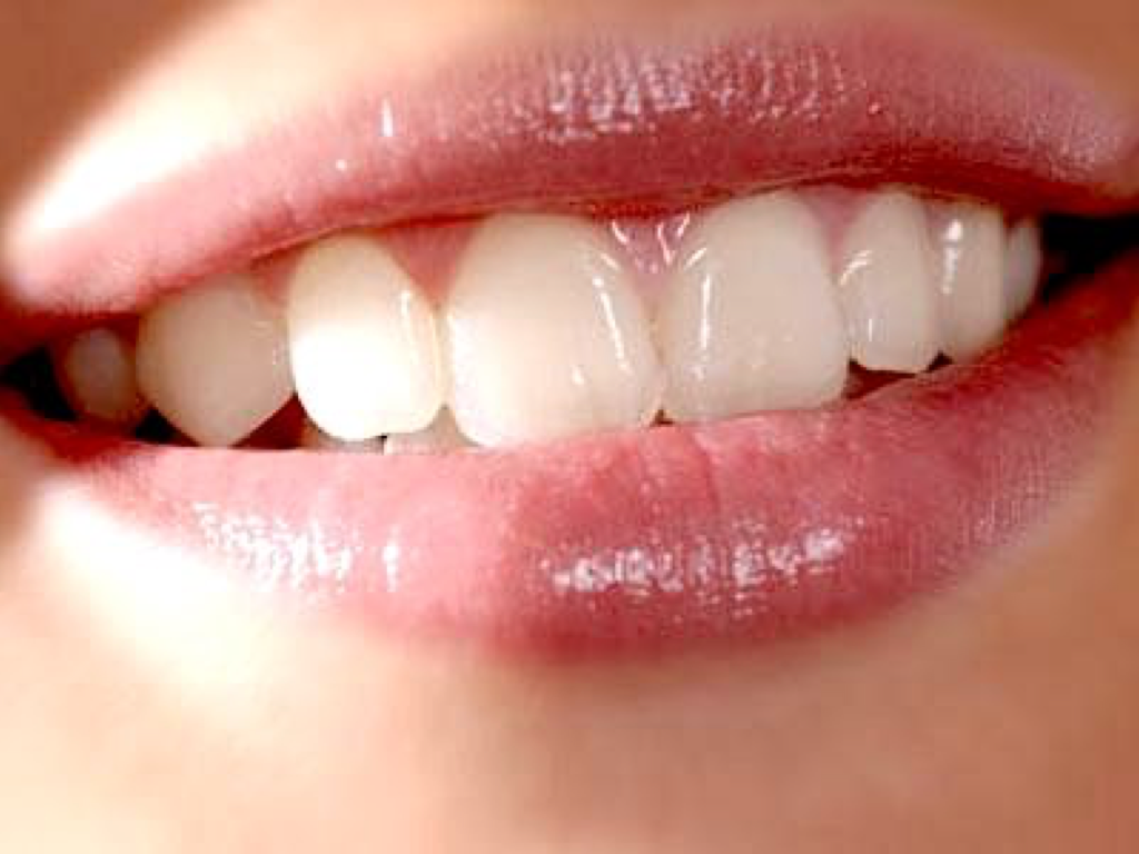 牙齿特别黄，有什么快速美白牙齿的方法？ - 知乎