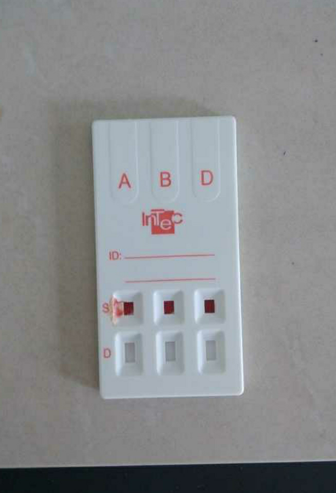 我们医院门诊会开展快速血型鉴定满足某些患者的需要和好奇心.