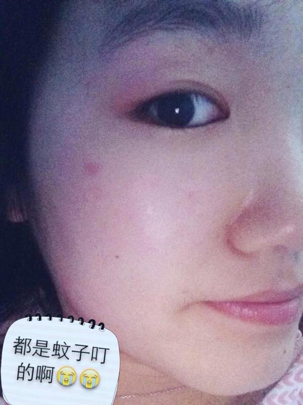为什么蚊子很少咬脸?