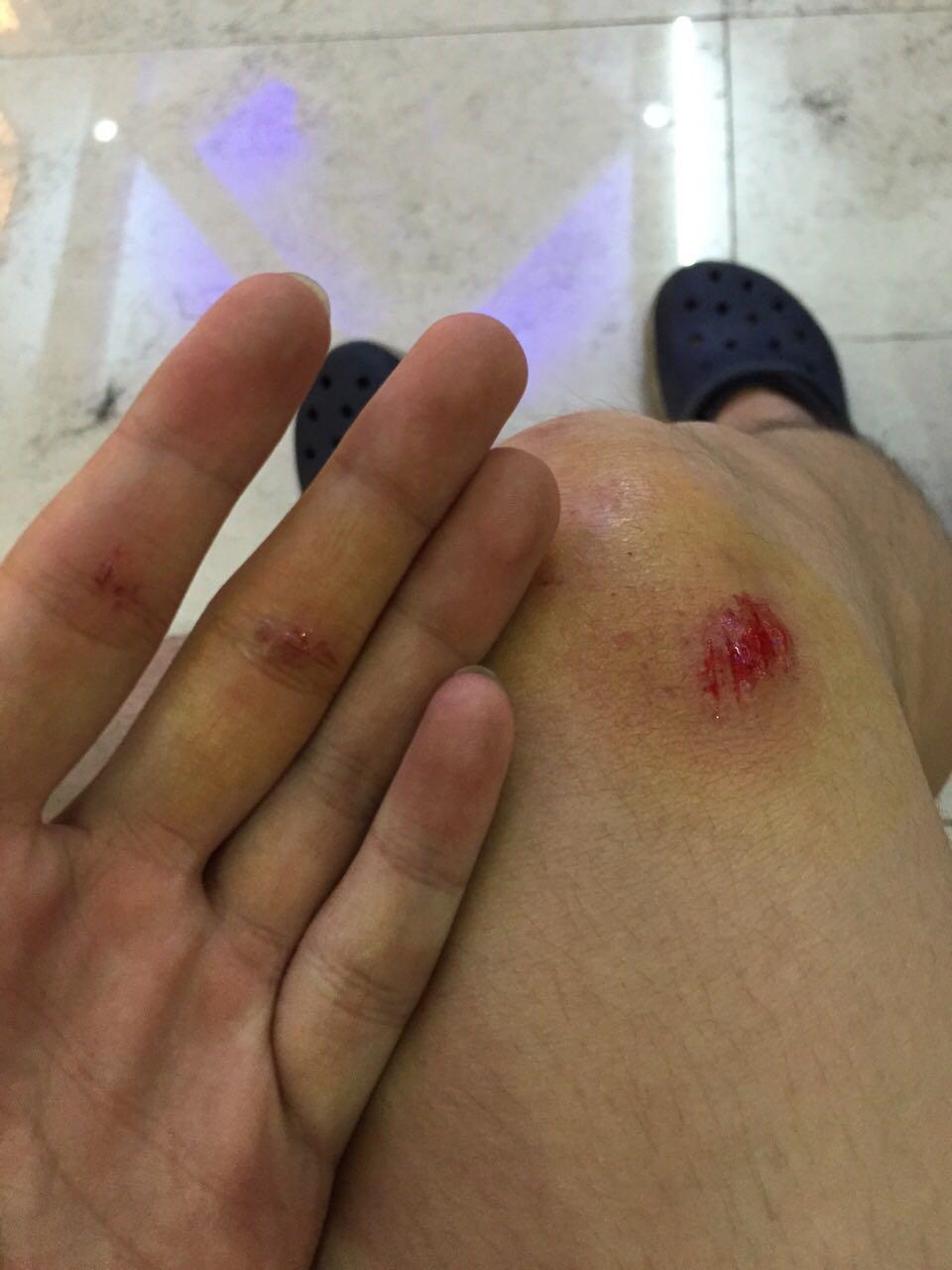 为什么人在摔倒,受伤的瞬间会觉得时间变慢?