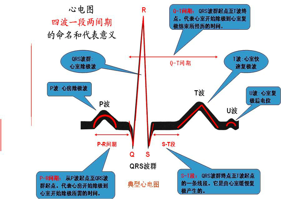 心电图有没有好的记忆口诀啊?还有就是比较生动形象的例子?