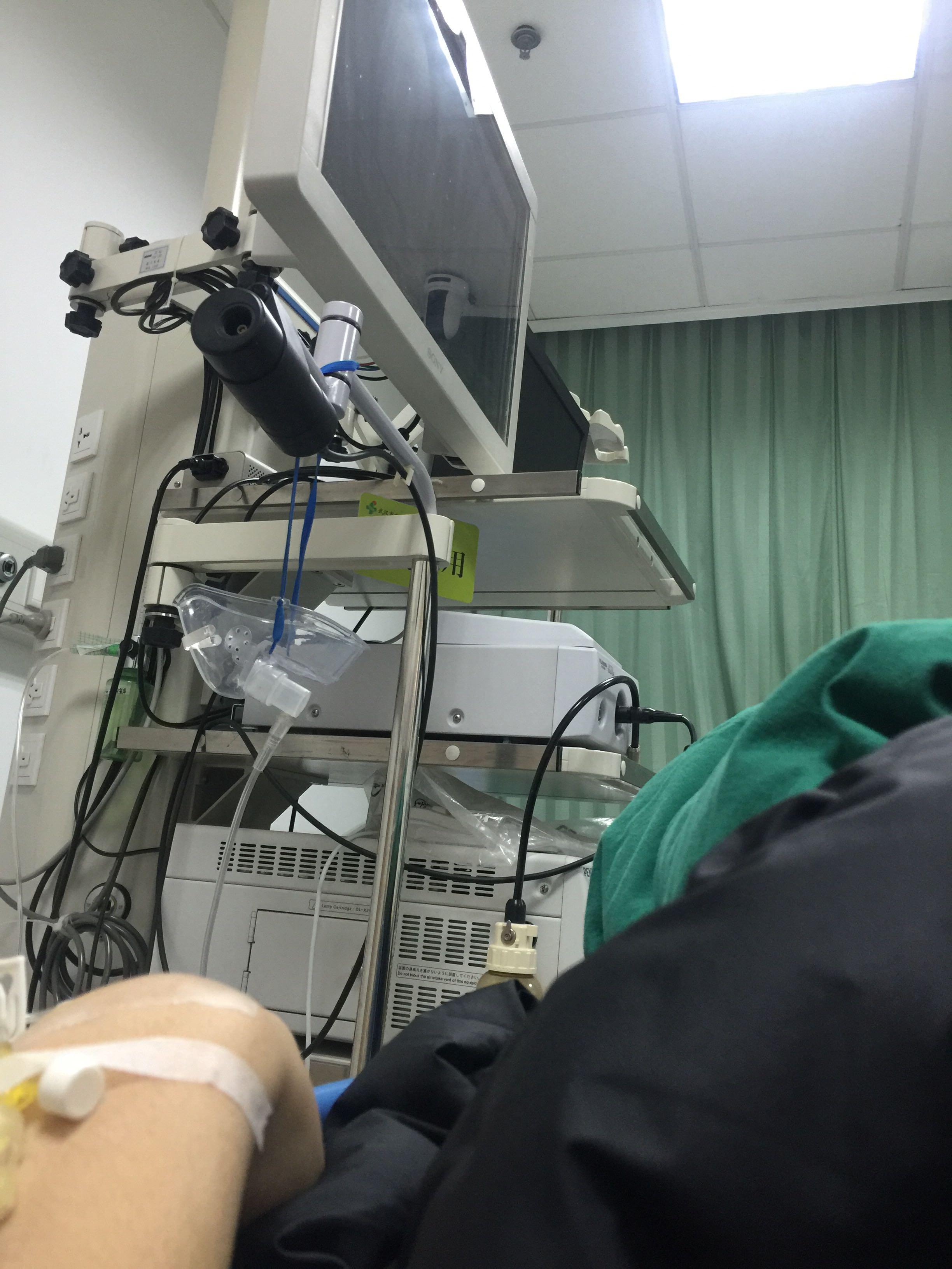 同时做全麻(不插管)胃镜肠镜是一种怎样的