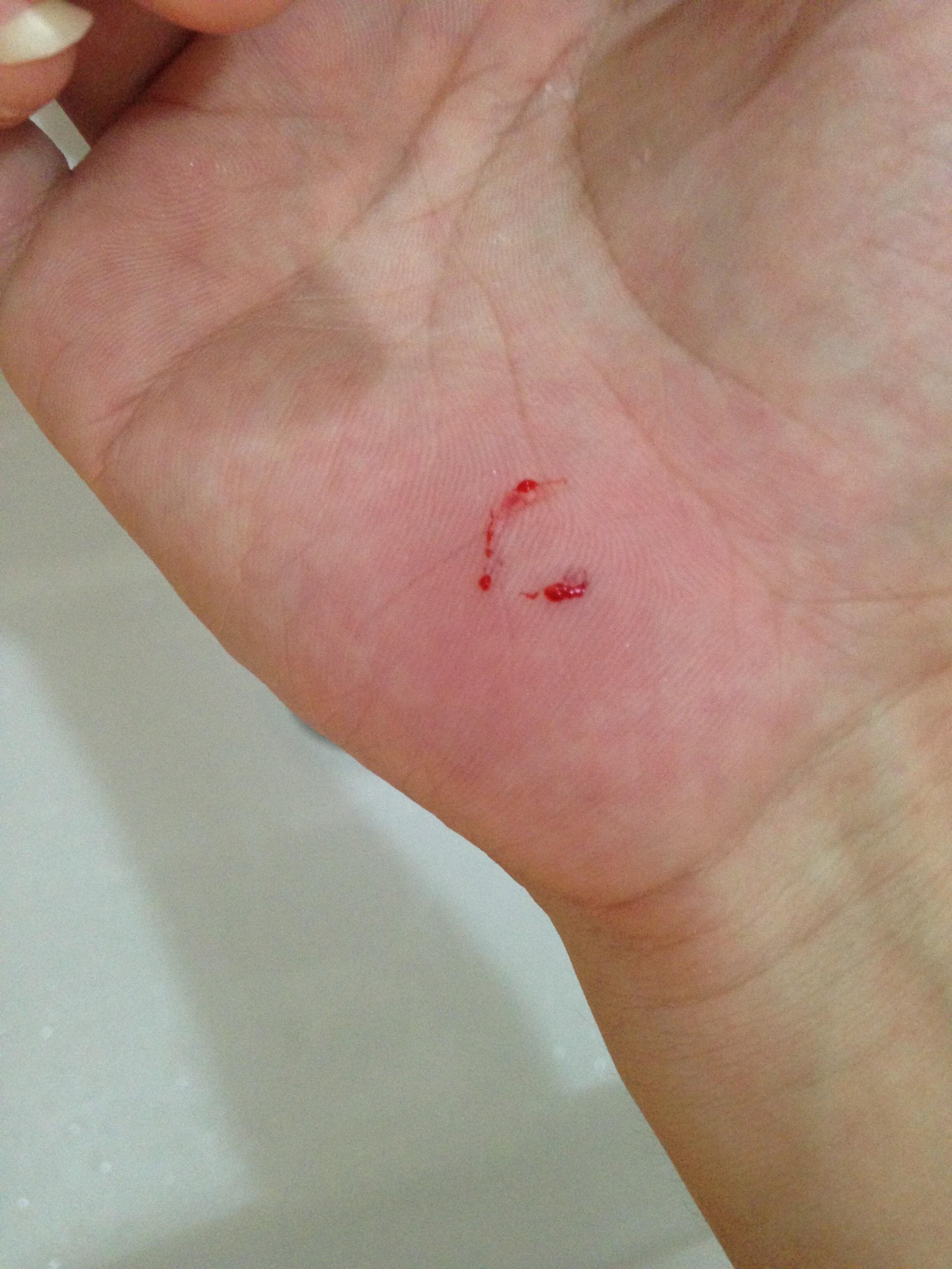 兔子的三角嘴咬人真的威力巨大吗感觉被咬的话很危险是因为三角形被