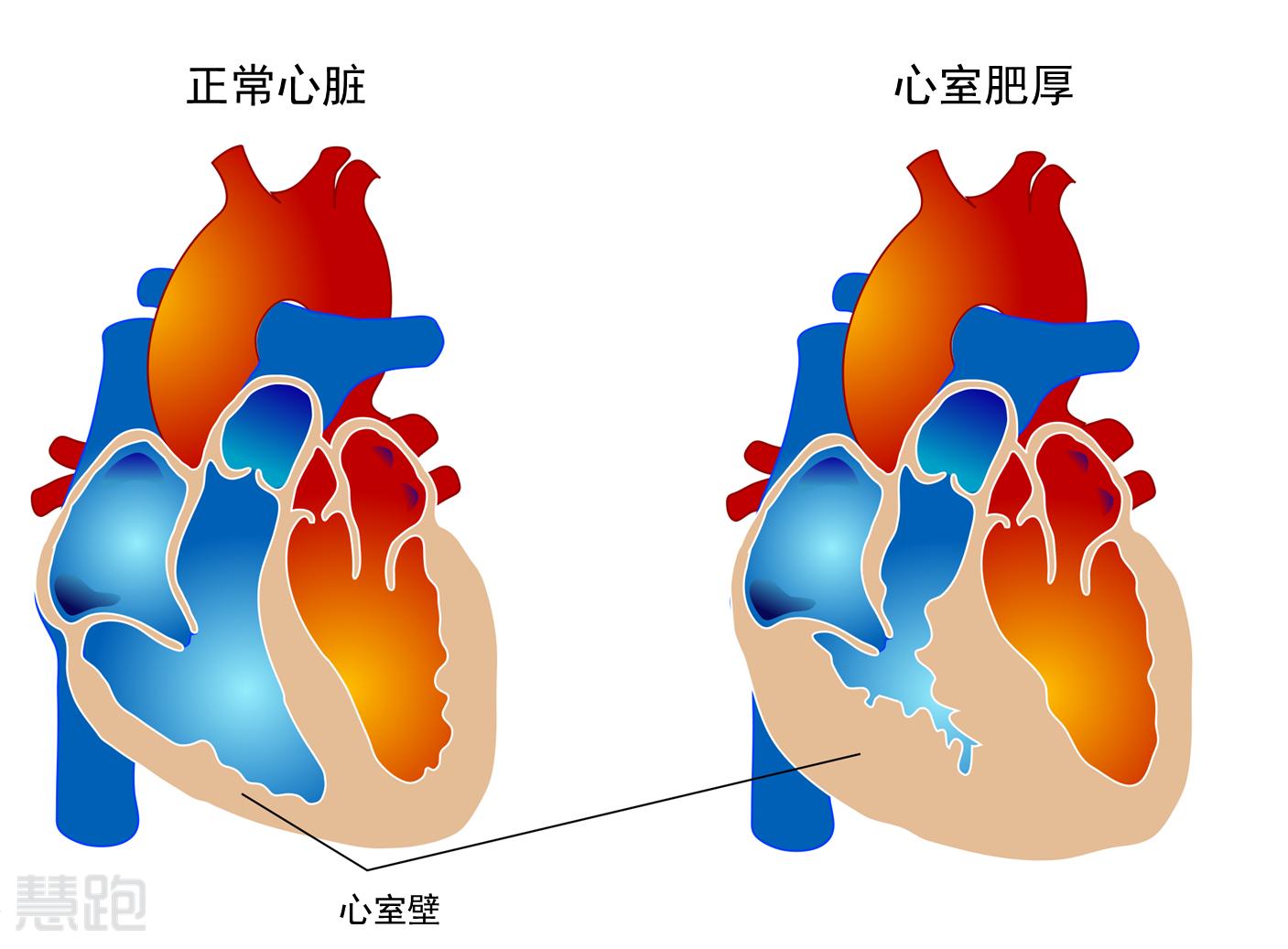 心脏解剖图片大全-心脏解剖高清图片下载-觅知网