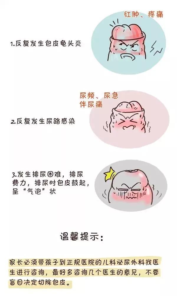 割包皮遇上女护士备皮或女医生指检主刀是种怎样的体验