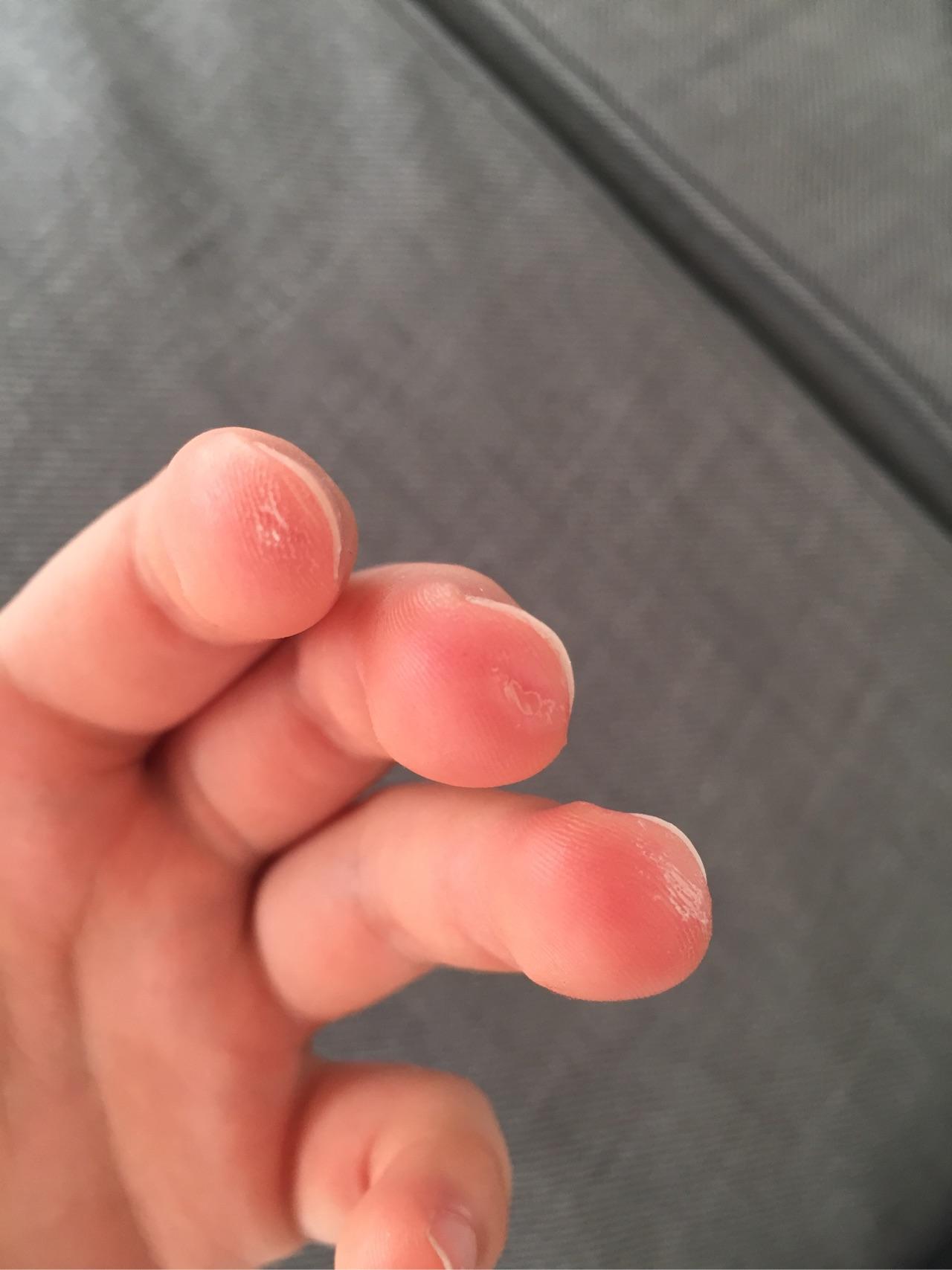 学吉他伤左手手指吗?