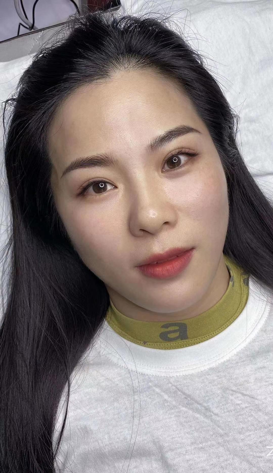 刚纹的眉毛太黑太粗了怎么办还有救吗