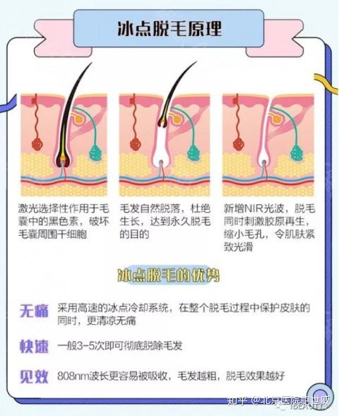 冰点脱毛是什么体验? 