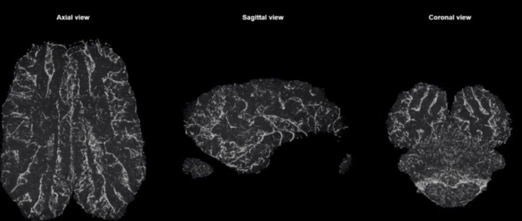 v2-005720b6ca90e8ff512372823a98d3e5_1440w.jpg?source=172ae18b